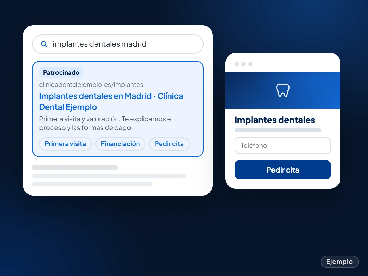 Ejemplo: búsqueda de implantes dentales en Madrid con el anuncio de una clínica y su página del tratamiento